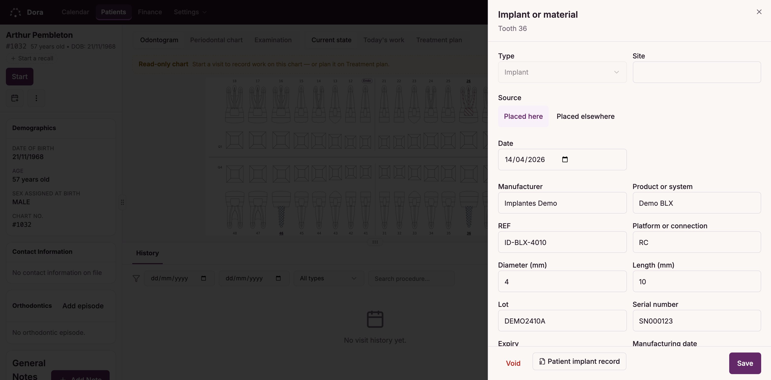 The Dora Dental implant record and the implant register for a fictional practice, with the implant and its materials listed.
