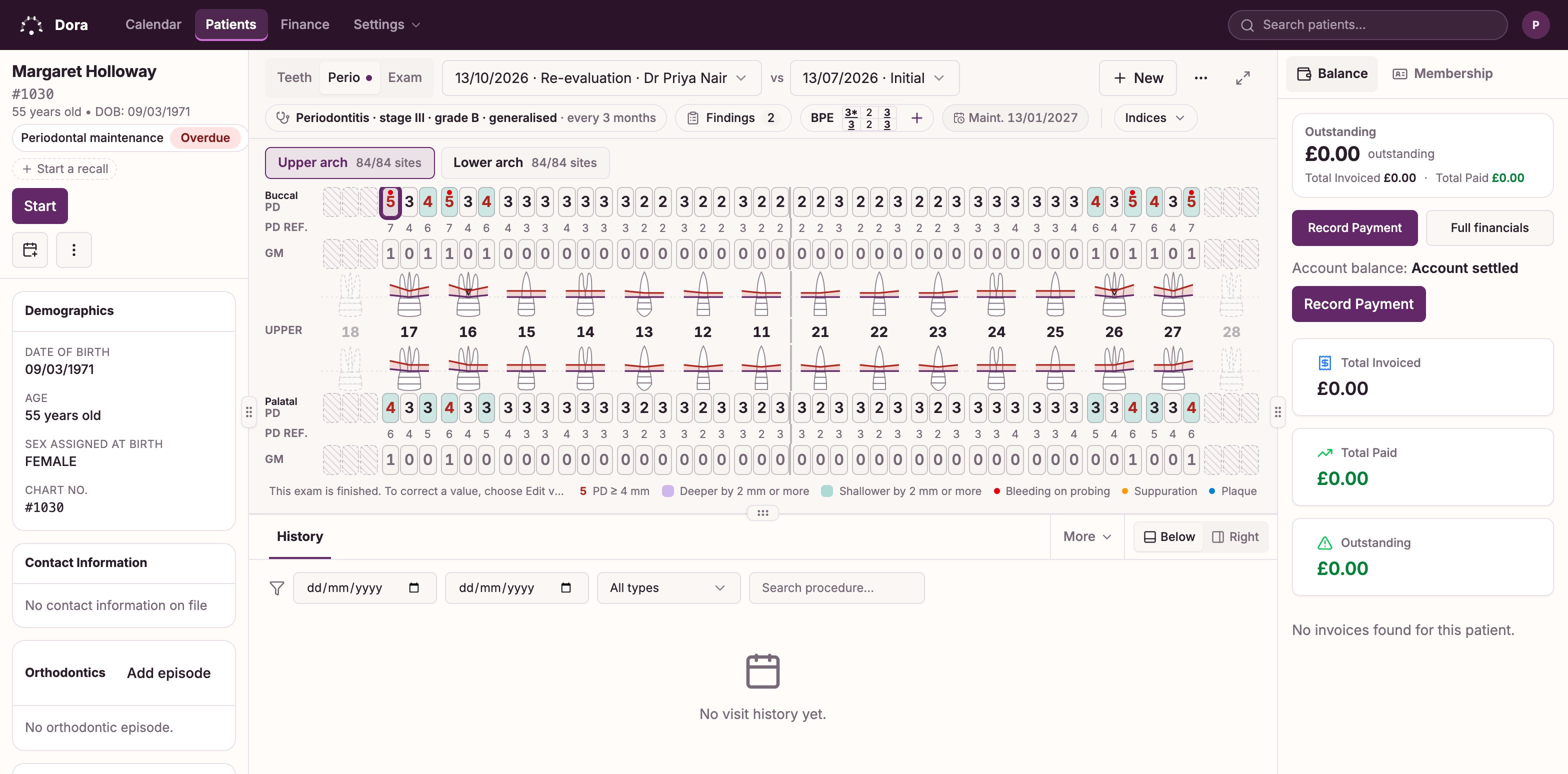 The Dora Dental periodontal chart for a fictional patient: probing depths, bleeding and recession entered by the clinician, shown beside the previous exam.