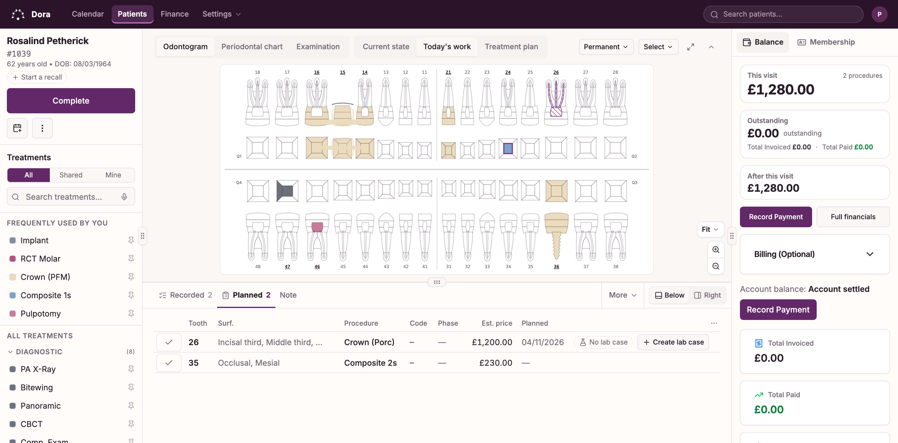 The Dora Dental visit screen: the full-mouth chart with today’s root canal and two fillings outlined, a bridge and an implant charted at earlier visits, the treatment list on the left, and on the right the treatments planned for this patient above today’s work, each line priced and billed.