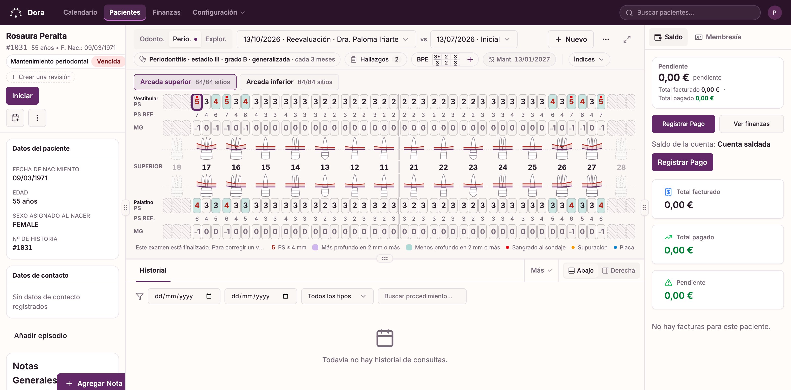 El periodontograma de Dora Dental de un paciente ficticio: profundidades de sondaje, sangrado y recesión anotados por el clínico, junto a la exploración anterior.