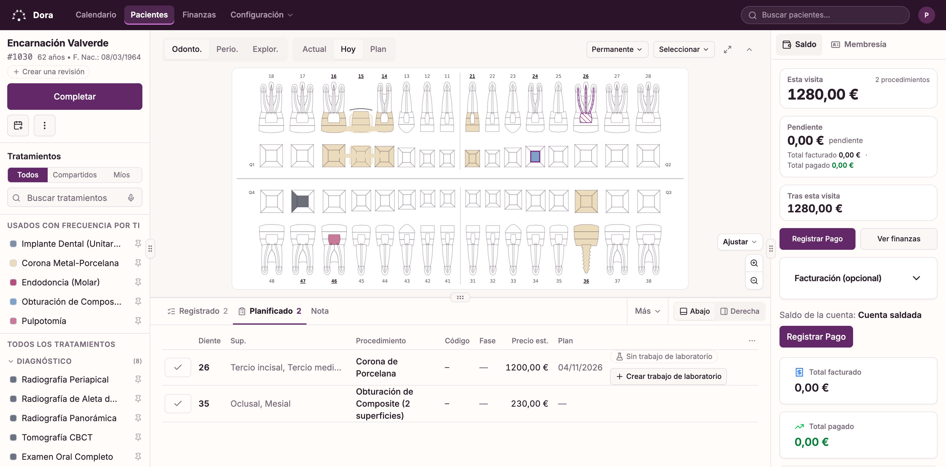 La pantalla de visita de Dora Dental: el odontograma completo con la endodoncia y dos obturaciones de hoy resaltadas, un puente y un implante registrados en visitas anteriores, la lista de tratamientos a la izquierda y, a la derecha, lo planificado para este paciente encima del trabajo de hoy, cada línea con su precio y facturada.