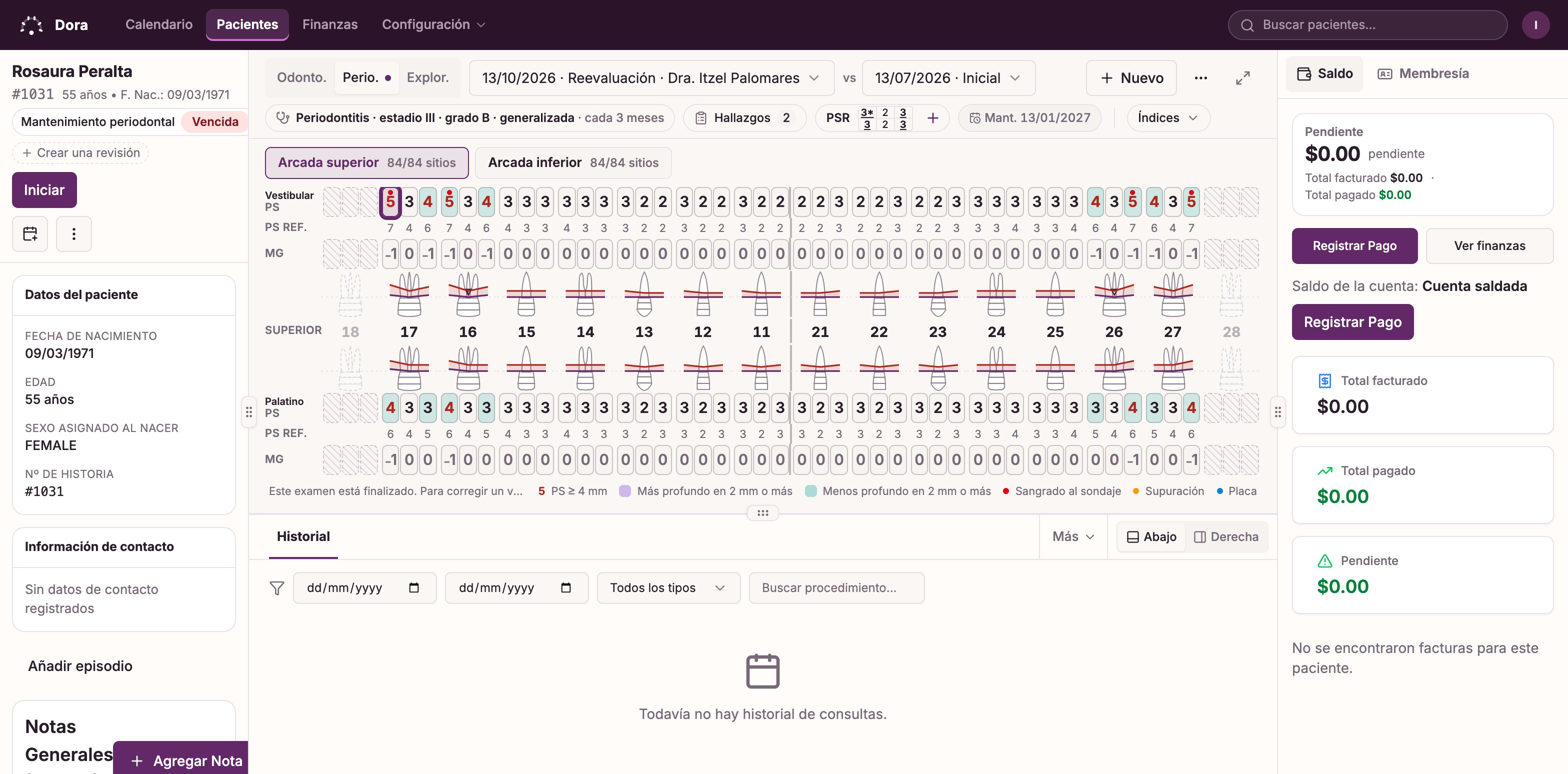El periodontograma de Dora Dental de un paciente ficticio: profundidades de sondaje, sangrado y recesión anotados por el clínico, junto a la exploración anterior.