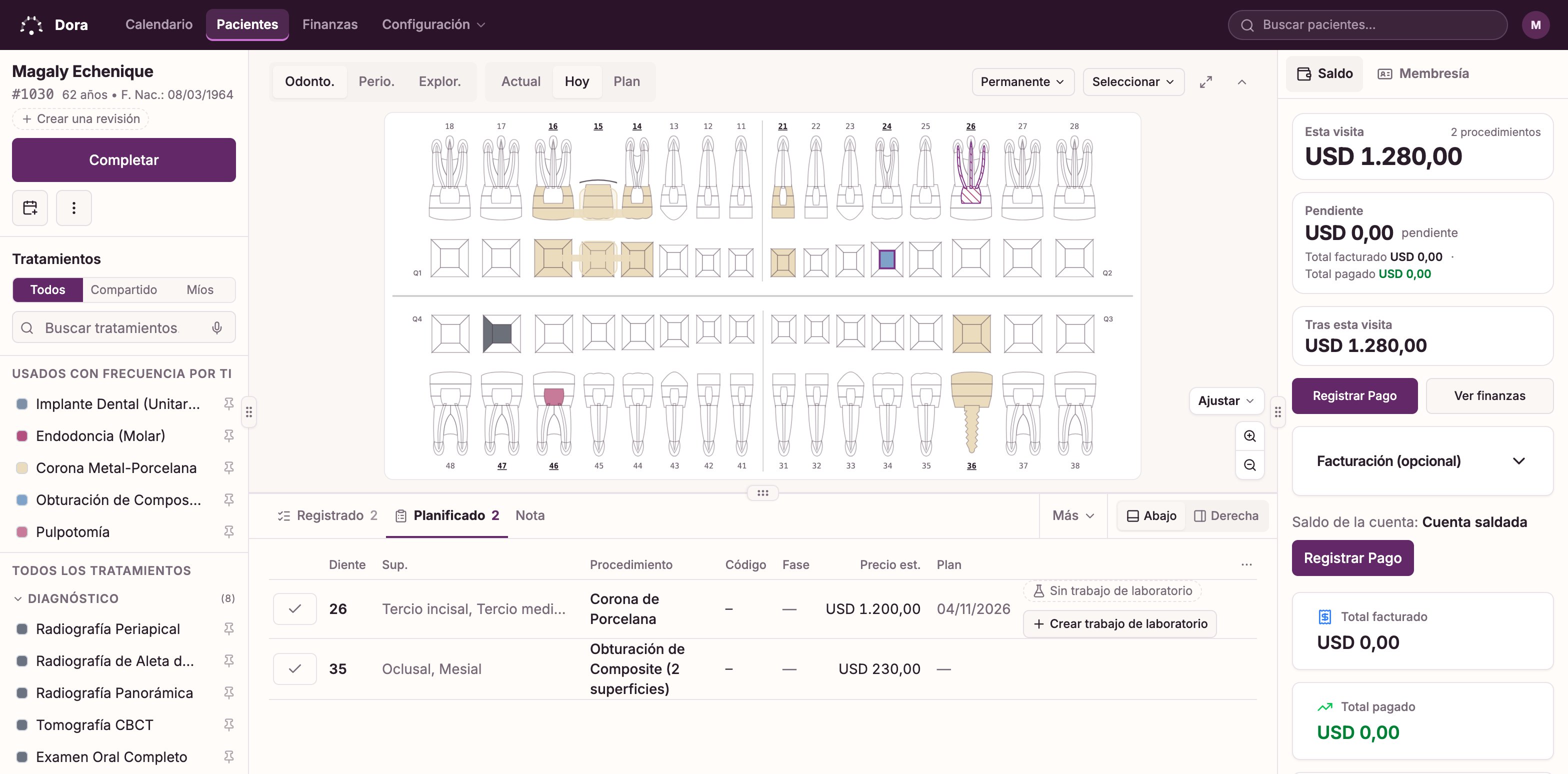 La pantalla de consulta de Dora Dental: el odontograma completo con la endodoncia y dos obturaciones de hoy resaltadas, un puente y un implante registrados en consultas anteriores, la lista de tratamientos a la izquierda y, a la derecha, lo planificado para este paciente encima del trabajo de hoy, cada línea con su precio y facturada.