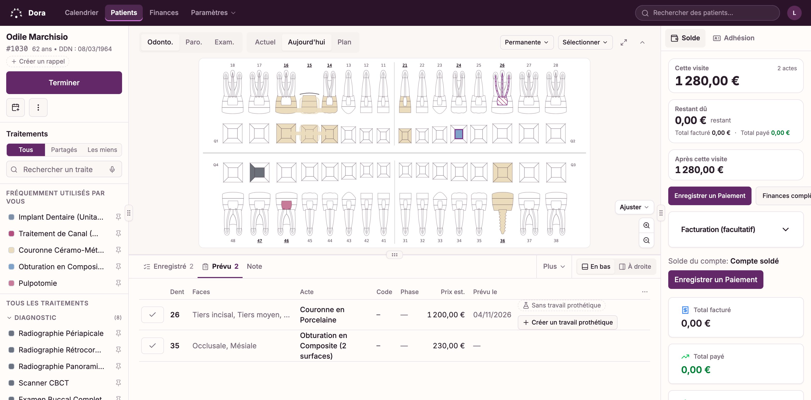 L’écran de consultation de Dora Dental : le schéma dentaire complet avec le traitement de canal et deux composites du jour mis en évidence, un bridge et un implant notés lors de consultations antérieures, la liste des actes à gauche et, à droite, les actes prévus pour ce patient au-dessus des soins du jour, chaque ligne chiffrée et facturée.